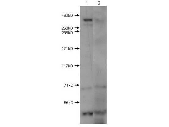Western Blot of Rabbit Anti-Huntington antibody