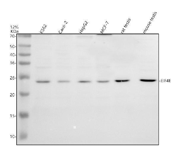 Western blot analysis of EIF4E using anti-EIF4E antibody (A00135-1)