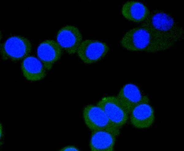 ICC staining Phospho-eIF4E(S209) in N2A cells (green)