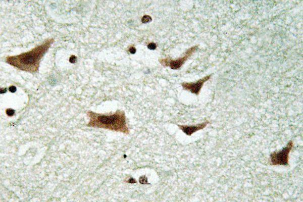 Immunohistochemistry (IHC) analyzes of p-eIF4E (S209) pAb in paraffin-embedded human brain tissue