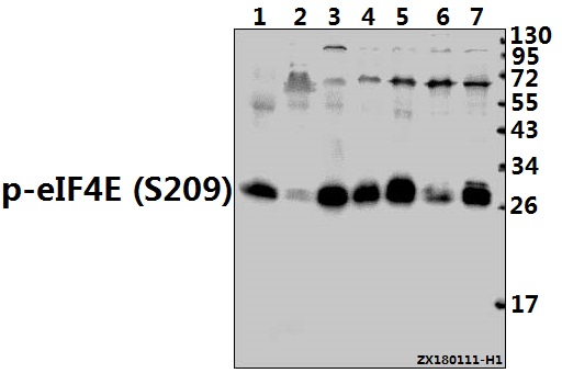 Western blot (WB) analysis of p-eIF4E (S209) pAb at 1:500 dilution
Lane1:The Lung tissue lysate of Mouse(40ug)
Lane2:The Brain tissue lysate of Rat(40ug)
Lane3:3T3-L1 whole cell lysate(40ug)
Lane4:C6 whole cell lysate(40ug)
Lane5:A2780 whole cell lysate(40ug)
Lane6:SK-OVCAR3 whole cell lysate(40ug)
Lane7:Panc1 whole cell lysate(20ug)
