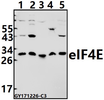 Western blot (WB) analysis of eIF4E (T203) pAb at 1:1000 dilution
Lane1:Hela whole cell lysate(40ug)
Lane2:SGC7901 whole cell lysate(40ug)
Lane3:The Spleen tissue lysate of Rat(40ug)
Lane4:3T3-L1 whole cell lysate(40ug)
Lane5:BV2 whole cell lysate(40ug)