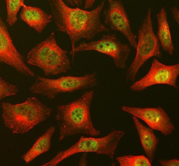  IF analysis of DNMT3A using anti-DNMT3A antibody (A00136-2) and anti-Beta Tubulin antibody (M01857-3)