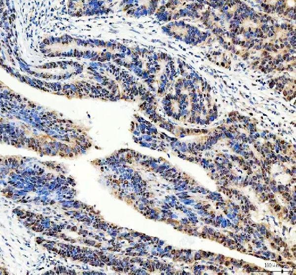  IHC analysis of DNMT3A using anti-DNMT3A antibody (A00136-2)