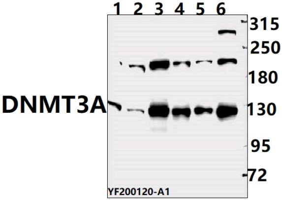 Western blot (WB) analysis of DNMT3A pAb at 1:500 dilution
Lane1:MEF whole cell lysate(40ug)
Lane2:H9C2 whole cell lysate(40ug) 
Lane3:HCT116 whole cell lysate(40ug)
Lane4:Jurkat  whole cell lysate(40ug)
Lane5:PC3 whole cell lysate (40ug)
Lane6:HEK293T whole cell lysate (40ug)