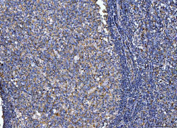  IHC analysis of CD14 using anti-CD14 antibody (A00137-2)