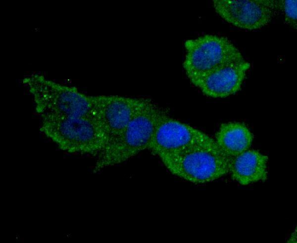 ICC staining MMP9 in Hela cells (green)