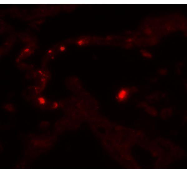 a00139 mmp9 primary antibodies if testing 3