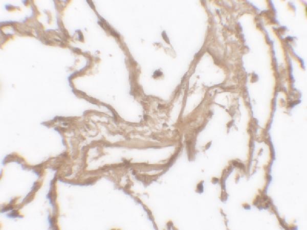 a00139 mmp9 primary antibodies ihc testing 2