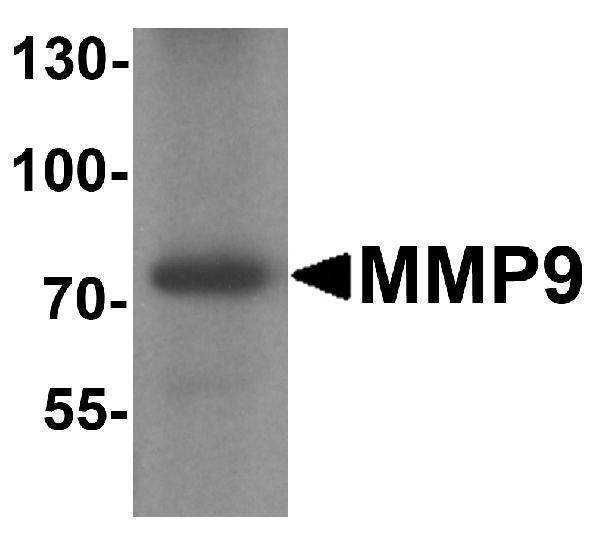a00139 mmp9 primary antibodies wb testing 1