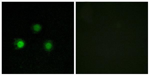 a00140 msh2 primary antibodies if testing 1