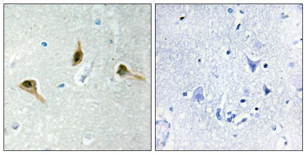a00140 msh2 primary antibodies ihc testing 2