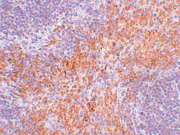 Immunohistochemistry of RIPK1 in mouse kidney tissue with RIPK1 antibody at 2
