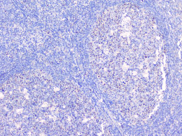 IHC analysis of Bcl6 using anti-Bcl6 antibody (A00142-1). Bcl6 was detected in paraffin-embedded section of human tonsil tissues. Heat mediated antigen retrieval was performed in citrate buffer (pH6, epitope retrieval solution) for 20 mins. The tissue section was blocked with 10% goat serum. The tissue section was then incubated with 1μg/ml rabbit anti-Bcl6 Antibody (A00142-1) overnight at 4°C. Biotinylated goat anti-rabbit IgG was used as secondary antibody and incubated for 30 minutes at 37°C. The tissue section was developed using Strepavidin-Biotin-Complex (SABC)(Catalog # SA1022) with DAB as the chromogen.