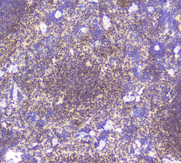 IHC analysis of Bcl6 using anti-Bcl6 antibody (A00142-1). Bcl6 was detected in paraffin-embedded section of mouse spleen tissues. Heat mediated antigen retrieval was performed in citrate buffer (pH6, epitope retrieval solution) for 20 mins. The tissue section was blocked with 10% goat serum. The tissue section was then incubated with 1μg/ml rabbit anti-Bcl6 Antibody (A00142-1) overnight at 4°C. Biotinylated goat anti-rabbit IgG was used as secondary antibody and incubated for 30 minutes at 37°C. The tissue section was developed using Strepavidin-Biotin-Complex (SABC)(Catalog # SA1022) with DAB as the chromogen.