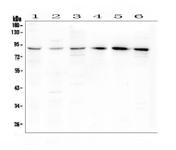 Western blot analysis of Bcl6 using anti-Bcl6 antibody (A00142-1). Electrophoresis was performed on a 5-20% SDS-PAGE gel at 70V (Stacking gel) / 90V (Resolving gel) for 2-3 hours. The sample well of each lane was loaded with 50ug of sample under reducing conditions. Lane 1: rat testis tissue lysate, Lane 2: rat spleen tissue lysate, Lane 3: rat brain tissue lysate, Lane 4: mouse testis tissue lysate, Lane 5: mouse spleen tissue lysate, Lane 6: mouse brain tissue lysate. After Electrophoresis, proteins were transferred to a Nitrocellulose membrane at 150mA for 50-90 minutes. Blocked the membrane with 5% Non-fat Milk/ TBS for 1.5 hour at RT. The membrane was incubated with rabbit anti-Bcl6 antigen affinity purified polyclonal antibody (Catalog # A00142-1) at 0.5 μg/mL overnight at 4°C, then washed with TBS-0.1%Tween 3 times with 5 minutes each and probed with a goat anti-rabbit IgG-HRP secondary antibody at a dilution of 1:10000 for 1.5 hour at RT. The signal is developed using an Enhanced Chemiluminescent detection (ECL) kit (Catalog # EK1002) with Tanon 5200 system. A specific band was detected for Bcl6 at approximately 88KD. The expected band size for Bcl6 is at 79KD.