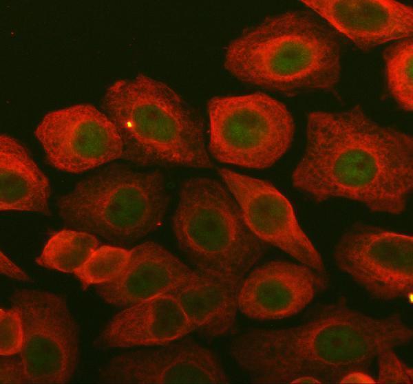 a00142 1 bcl6 primary antibodies if testing 1