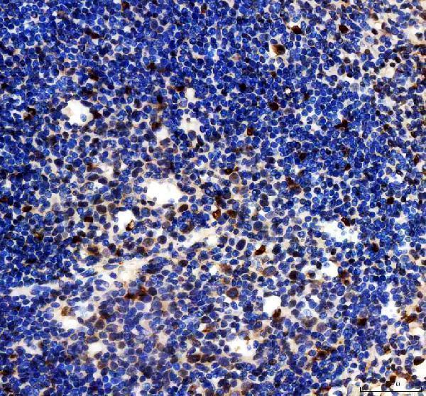 IHC analysis of BCL6 using anti-BCL6 antibody (A00142-1)