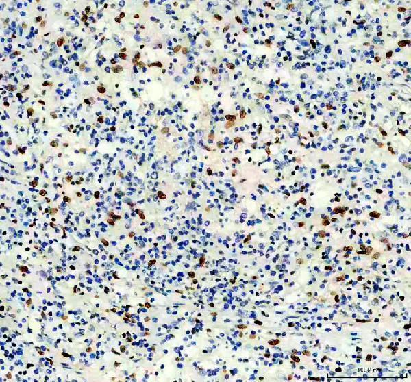 IHC analysis of BCL6 using anti-BCL6 antibody (A00142-1)