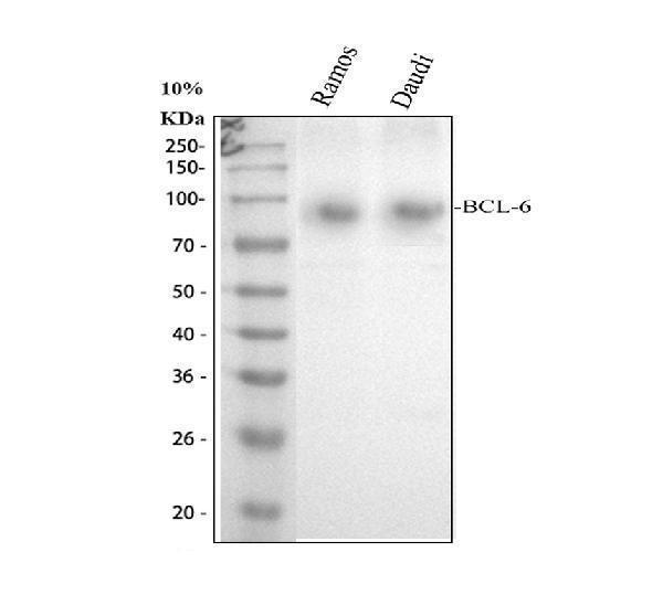 Western blot analysis of BCL6 using anti-BCL6 antibody (A00142-1)