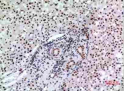 Immunohistochemistry (IHC) analysis of paraffin-embedded Human Liver, antibody was diluted at 1:100