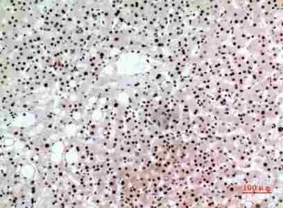 a00142 bcl6 primary antibodyes ihc testing 4