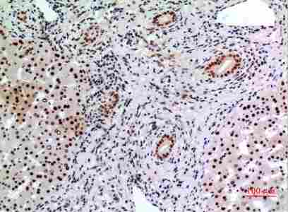 a00142 bcl6 primary antibodyes ihc testing 5