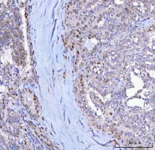 a00145 1 p21 primary anibodies ihc testing 2