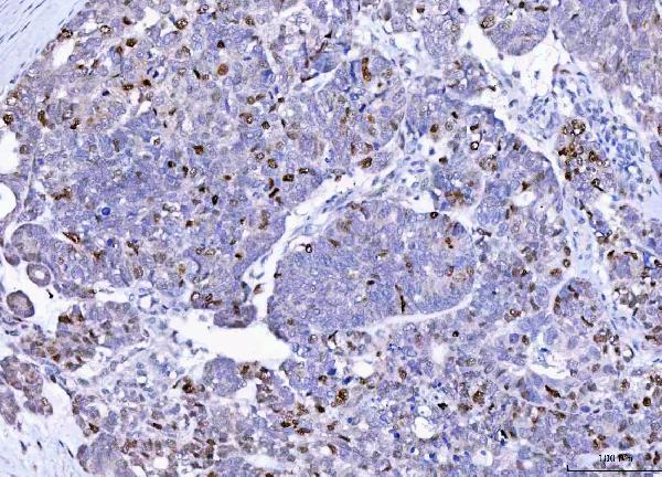 a00145 1 p21 primary anibodies ihc testing 3