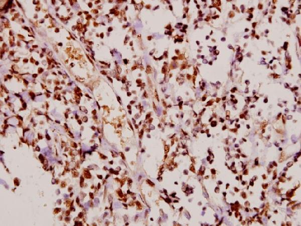 a00145t145 cdkn1a primary antiboties ihc testing 2