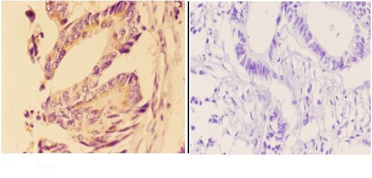 a00146 2 ang primary antiboties ihc testing 2