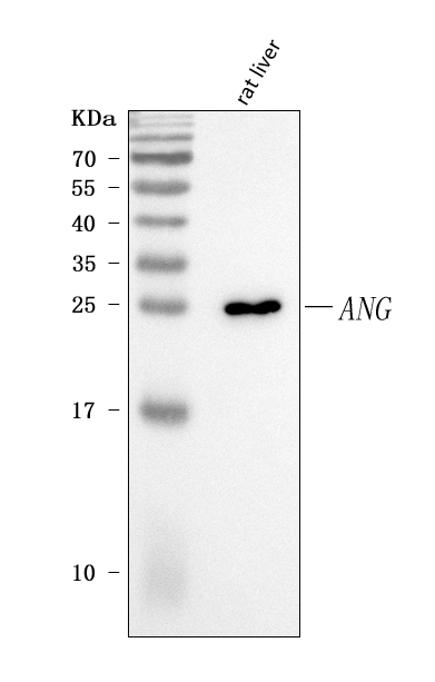  Western blot analysis of Angiogenin/Ang using anti-Angiogenin/Ang antibody (A00146-3)