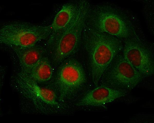 a00146 ang primary antibodies if testing 4