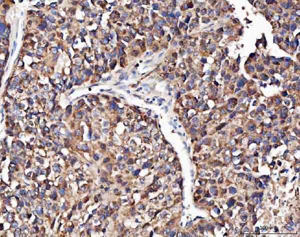 a00146 ang primary antibodies ihc testing 2