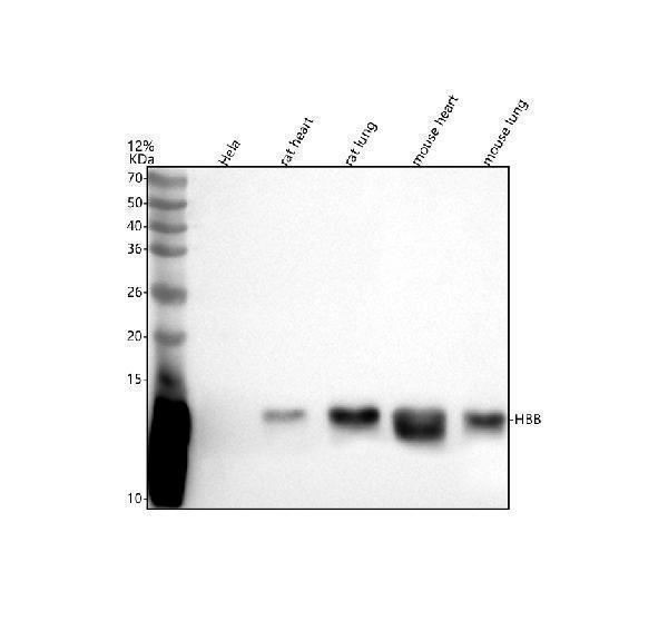  Western blot analysis of HBB using anti-HBB antibody (A00147-1)