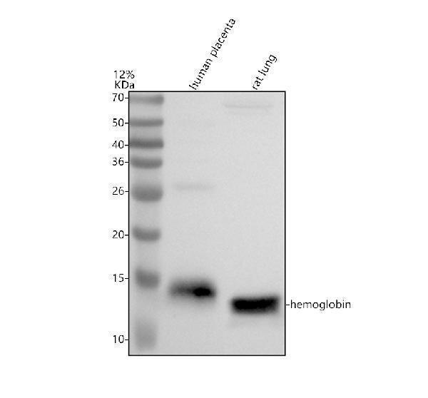 a00147 2 hemoglobin primary antibodies wb testing 1