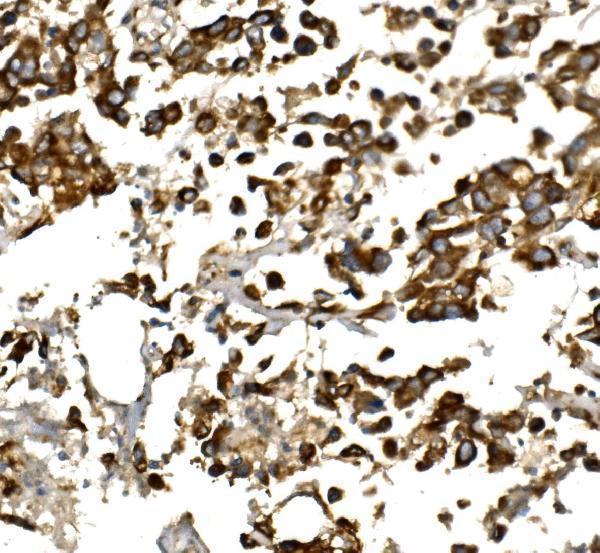 a00148 igf1 primary antibodies ihc testing 1