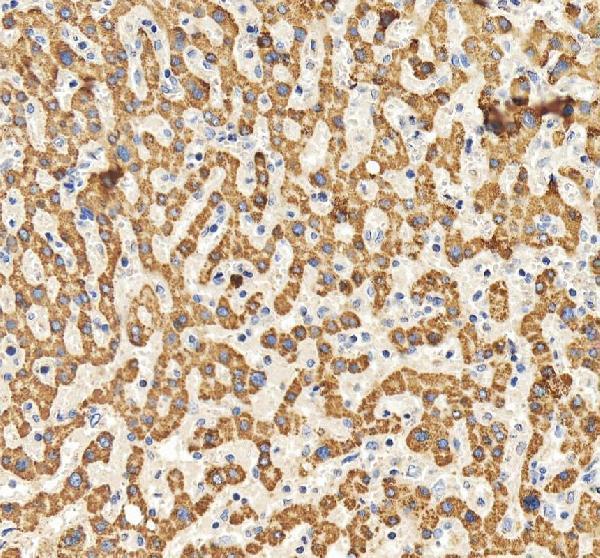 a00148 igf1 primary antibodies ihc testing 2