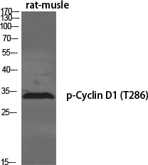 Western Blot analysis of various cells using Phospho-Cyclin D1 (T286) Polyclonal Antibody diluted at 1:500