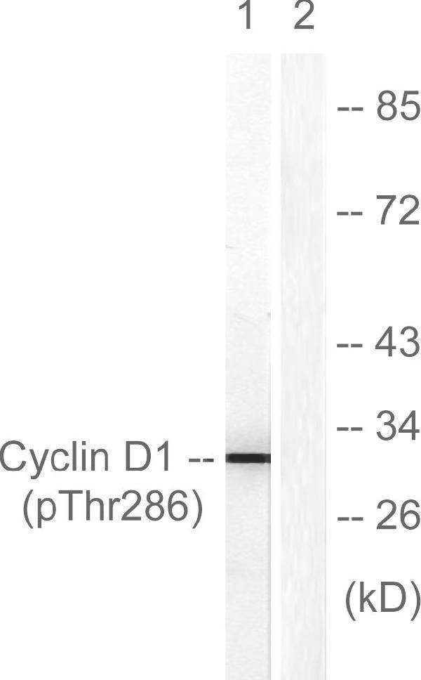 Western blot analysis of lysates from Jurkat cells treated with EGF 200ng/ml 30