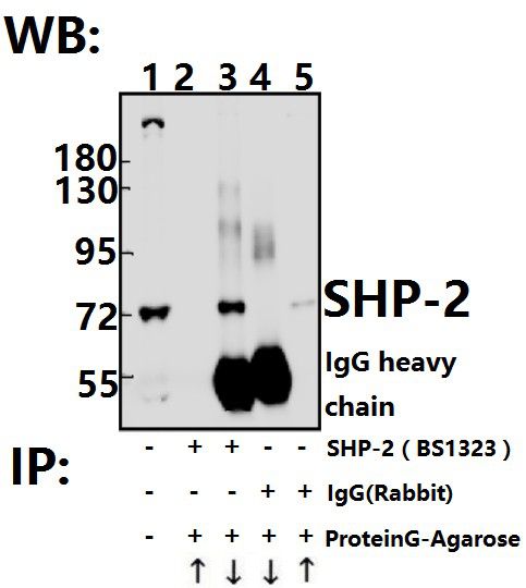 Immunoprecipitation of L02 cell lysate using SHP-2 (S350) pAb (Sepharose Bead Conjugate) #BD0048(lane 2 and lane 3) and Nonspecific IgG  Control (Sepharose Bead Conjugate)#BD0047 (lane 4 and lane 5) 