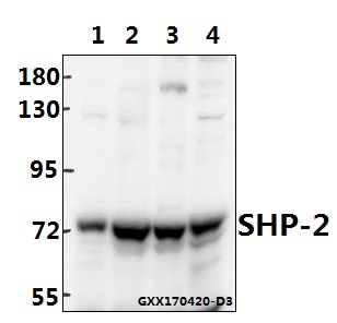 Western blot (WB) analysis of SHP-2 (K536) polyclonal antibody at 1:500 dilution
Lane1:MCF-7 whole cell lysate(40ug)
Lane2:A549 whole cell lysate(40ug)
Lane3:CT26 whole cell lysate(40ug)
Lane4:PC12 whole cell lysate(40ug)