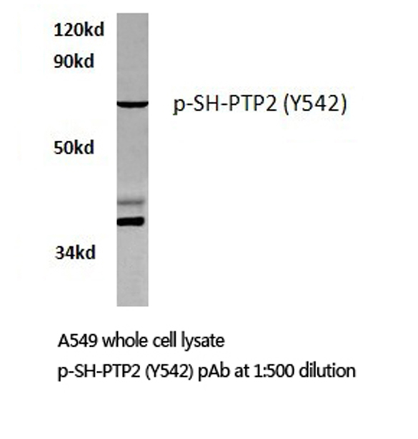 Western blot (WB) analysis of p-SHP-2 (Y542) polyclonal antibody at 1:500 dilution
Lane1:A549 whole cell lysate
Lane2:Raw264
