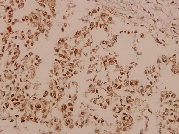 a00151 ptk2 primary antiboties ihc testing 2