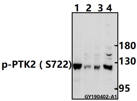 a00151s722 ptk2 primary antiboties wb testing 1