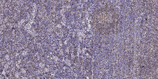 a00151s732 ptk2 primary antibodies ihc testing 1