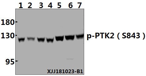 a00151s843 ptk2 primary antiboties wb testing 1
