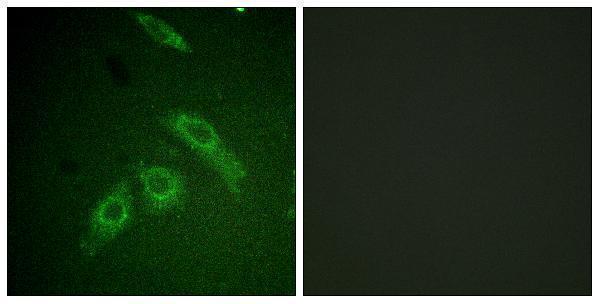 a00151s910 ptk2 primary antibodies if testing 1