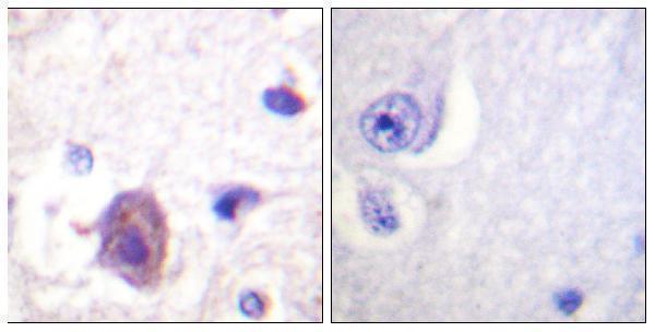a00151s910 ptk2 primary antibodies ihc testing 2