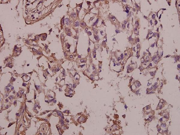 a00151y397 ptk2 primary antiboties ihc testing 2
